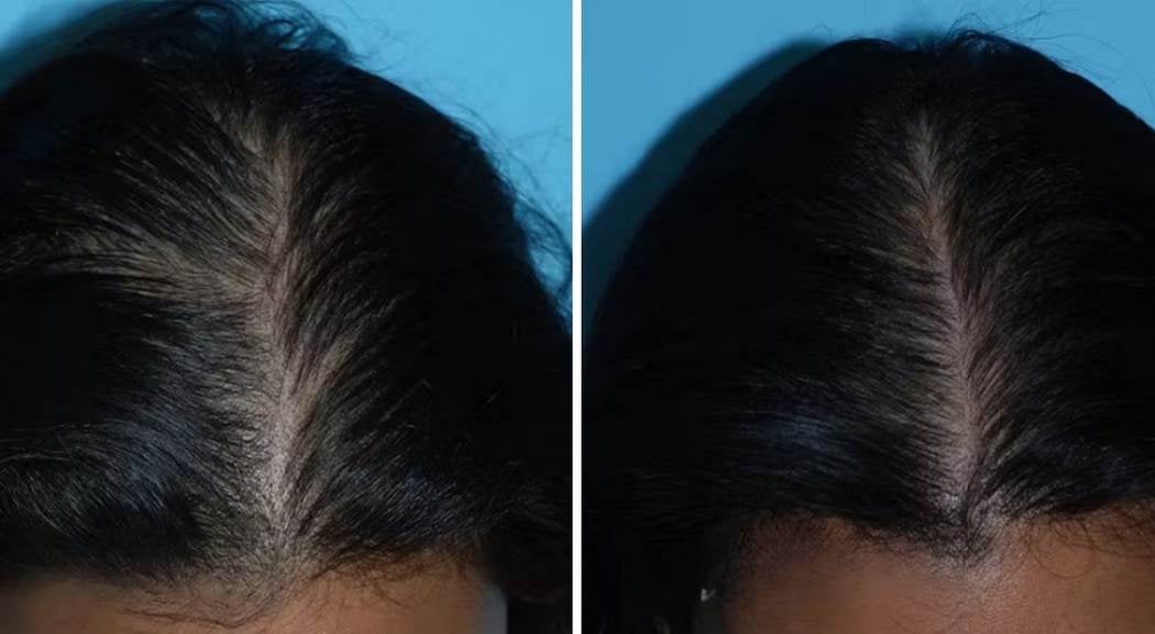 Hair before and after