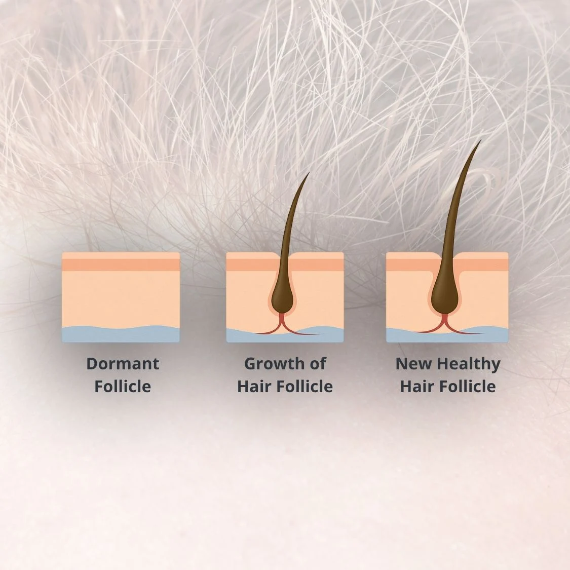 Collagen pills and powders don't work